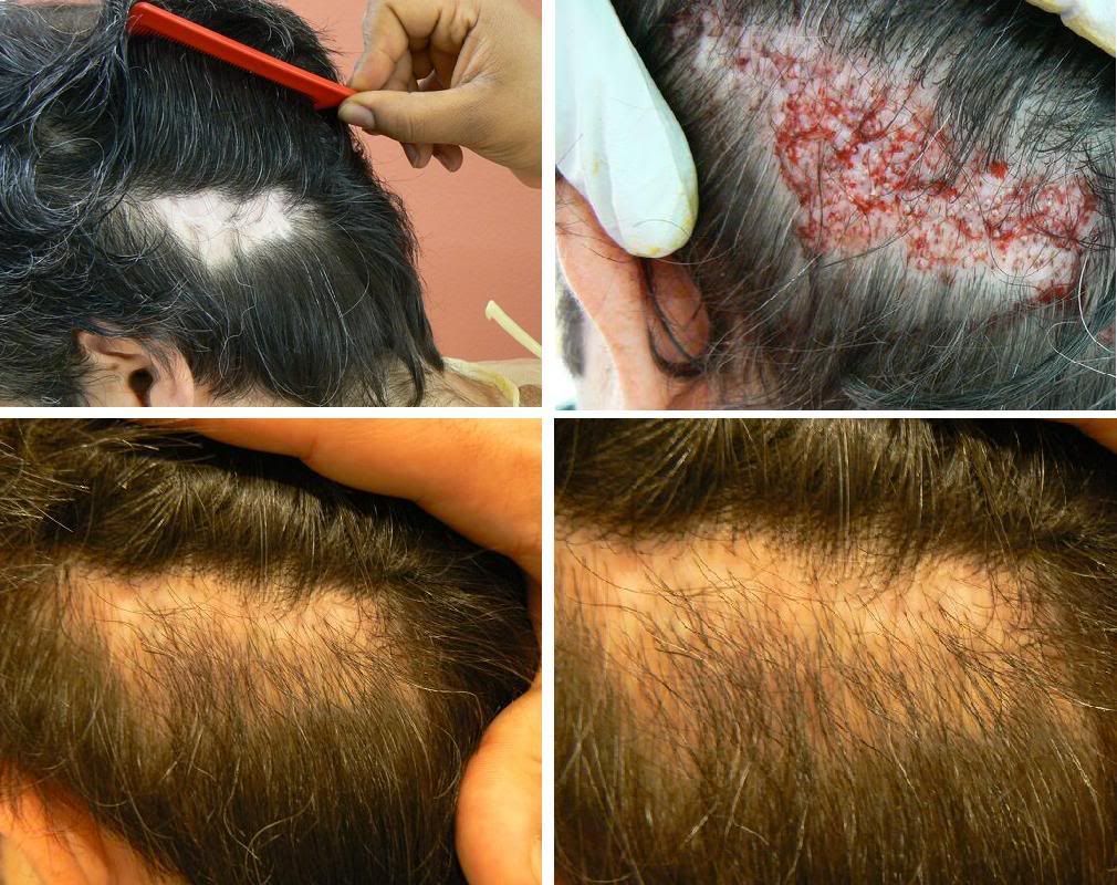 I capelli come paglia che per fare rimedi di gente